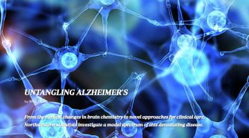 New model of Alzheimer's disease