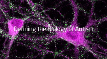 Defining the Biology of Autism